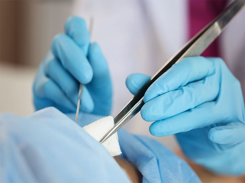 Minor Procedures